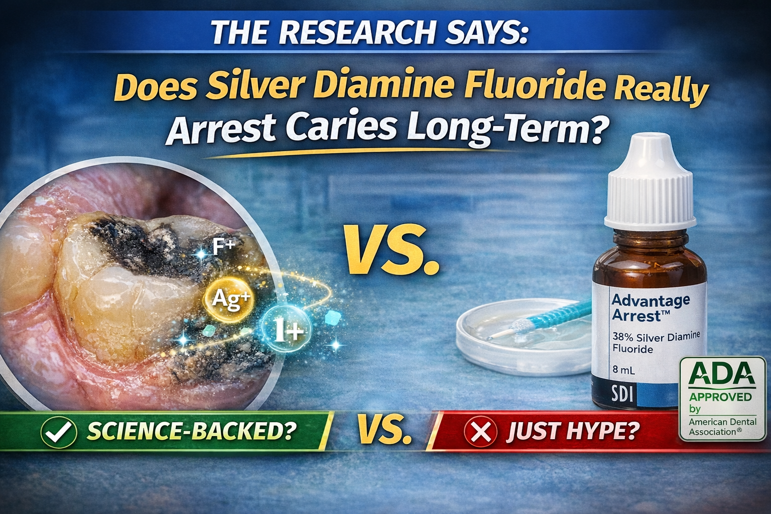 Evidence-based analysis of silver diamine fluoride and long-term caries arrest in dentistry